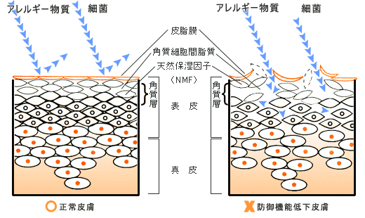 新ピフォニーＵ軟膏の写真-04